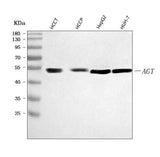 Anti-Angiotensinogen/AGT Antibody Picoband® Boster Bio