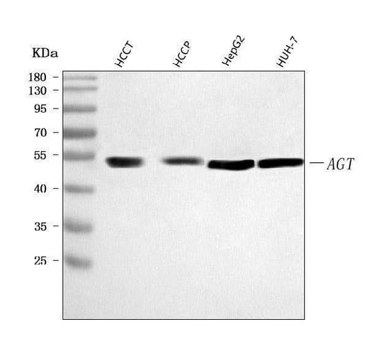 Anti-Angiotensinogen/AGT Antibody Picoband® Boster Bio