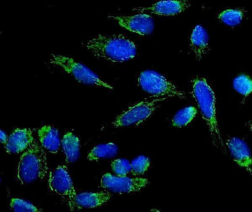 Anti-beta 3 Adrenergic Receptor/ADRB3 Antibody Picoband® Boster Bio
