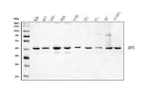 Anti-DHPS/DHS Antibody Picoband® Boster Bio