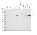 Anti-CPT2/CPT1 Antibody Picoband® Boster Bio