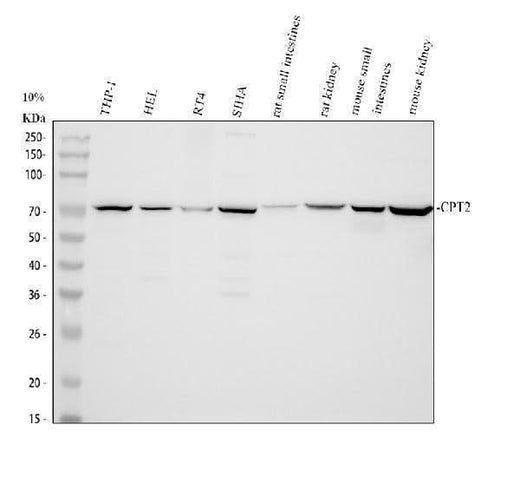 Anti-CPT2/CPT1 Antibody Picoband® Boster Bio