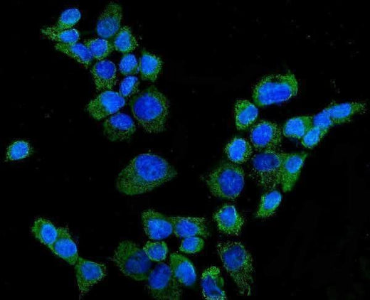 Anti-CYP27A1 Antibody Picoband® Boster Bio