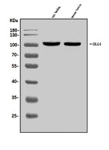 Anti-PSD95/DLG4 Antibody Picoband® Boster Bio