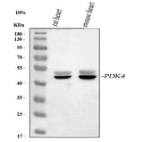 Anti-PDK4 Antibody Picoband® Boster Bio