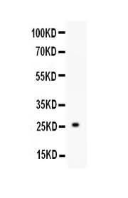 Anti-TREM1 Antibody Picoband® Boster Bio