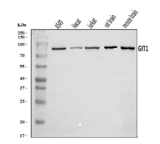 Anti-GIT1 Antibody Picoband® Boster Bio