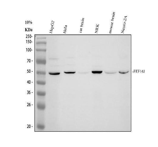 Anti-ACAA1 Antibody Picoband® Boster Bio