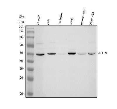Anti-ACAA1 Antibody Picoband® Boster Bio