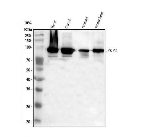 Anti-Plakophilin 2/PKP2 Antibody Picoband® Boster Bio