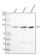 Anti-PKP2 Antibody Picoband® Boster Bio