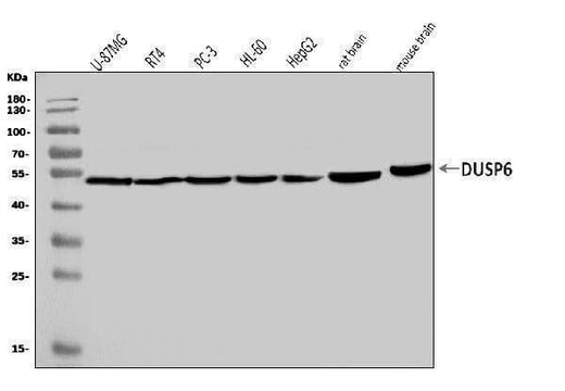 Anti-DUSP6 Antibody Picoband® Boster Bio