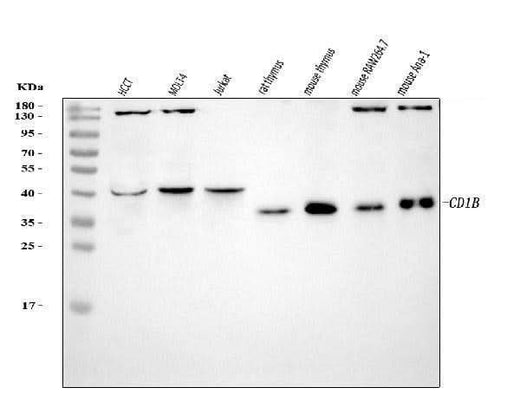 Anti-CD1B Antibody Picoband® Boster Bio