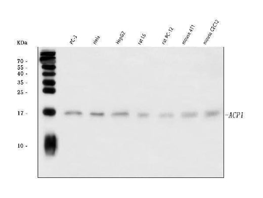 Anti-Acid phosphatase/ACP1 Antibody Picoband® Boster Bio