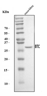 Anti-Btc Antibody Picoband® Boster Bio