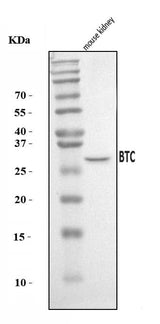 Anti-Btc Antibody Picoband® Boster Bio