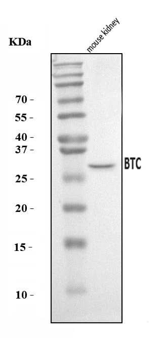 Anti-Btc Antibody Picoband® Boster Bio