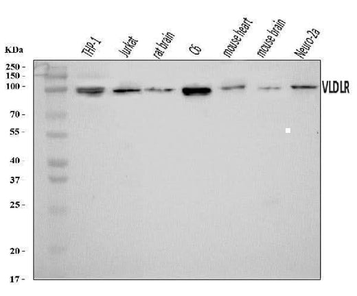 Anti-VLDL Receptor/VLDLR Antibody Picoband® Boster Bio