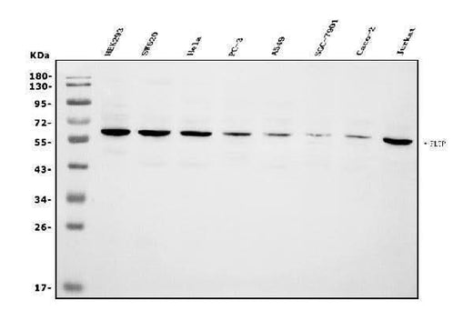 Anti-PLTP Antibody Picoband® Boster Bio
