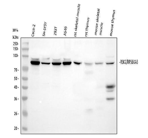 Anti-Rsk 2/MAPKAP Kinase 1b/RPS6KA3 Picoband® Antibody Boster Bio