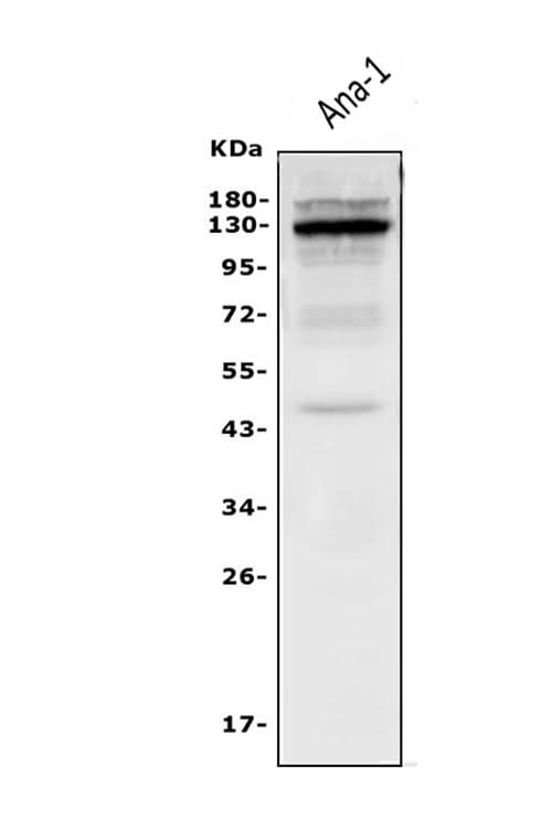 Anti-IL-3RB/Csf2rb Antibody Picoband® Boster Bio