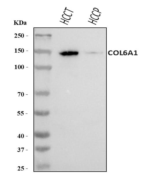 Anti-COL6A1 Antibody Picoband® Boster Bio