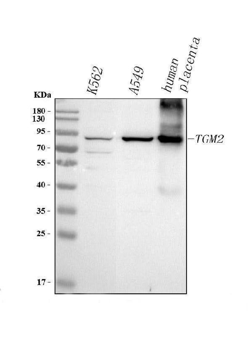 Anti-TGM2 Antibody Picoband® Boster Bio