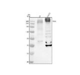 Anti-SETX Antibody Picoband® Boster Bio