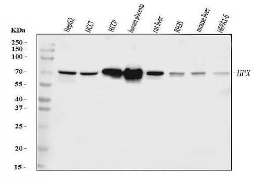 Anti-Hemopexin/HPX Antibody Picoband® Boster Bio