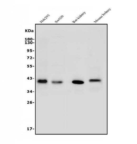 Anti-ARG2 Antibody Picoband® Boster Bio