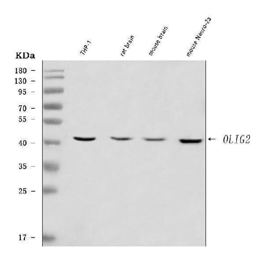 Anti-OLIG2 Antibody Picoband® Boster Bio