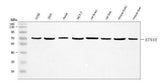 Anti-Nogo receptor/NgR1/RTN4R Antibody Picoband® Boster Bio