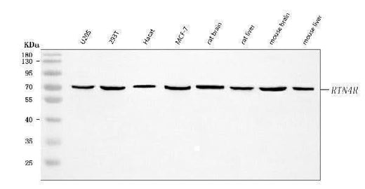 Anti-Nogo receptor/NgR1/RTN4R Antibody Picoband® Boster Bio