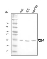 Anti-PDGF AA/PDGFA Antibody Picoband® Boster Bio