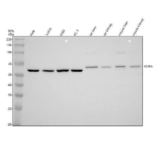 Anti-RORA Antibody Picoband® Boster Bio