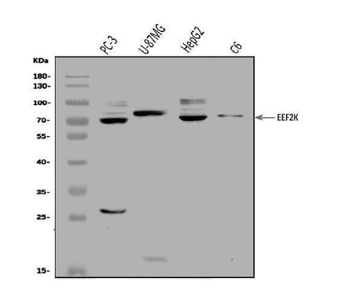 Anti-EEF2K Antibody Picoband® Boster Bio