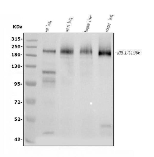 Anti-Mannose Receptor/MRC1 Picoband® Antibody Boster Bio