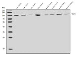 Anti-ClC-5/CLCN5 Antibody Picoband® Boster Bio