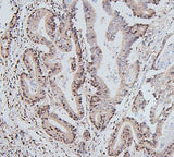 Anti-UBE2I/UBC9 Antibody Picoband® Boster Bio