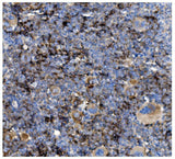 Anti-CD82 Antibody Boster Bio