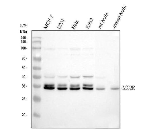 Anti-MC2 receptor/MC2R Antibody Picoband® Boster Bio