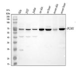 Anti-PGM1 Antibody Picoband® Boster Bio