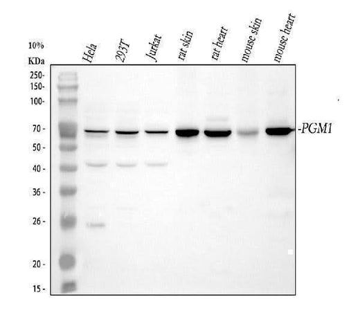 Anti-PGM1 Antibody Picoband® Boster Bio