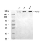Anti-DEP1/PTPRJ Antibody Picoband® Boster Bio