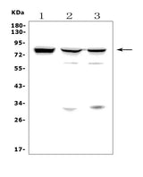 Anti-MASP2 Antibody Picoband® Boster Bio