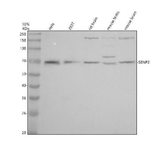 Anti-SENP2 Antibody Picoband® Boster Bio