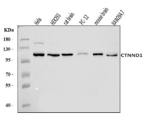 Anti-delta 1 Catenin/CAS/CTNND1 Antibody Picoband® Boster Bio