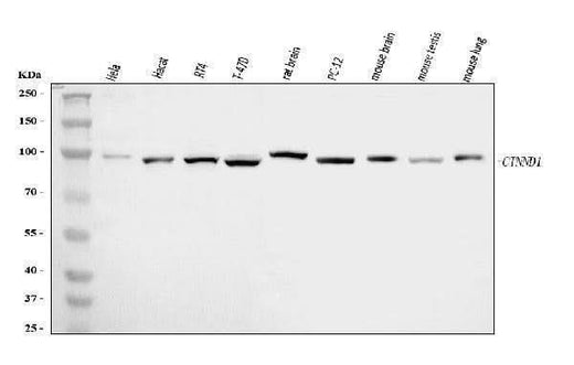 Anti-delta 1 Catenin/CAS/CTNND1 Antibody Picoband® Boster Bio