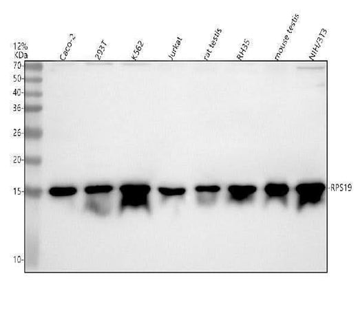 Anti-RPS19 Antibody Picoband® Boster Bio