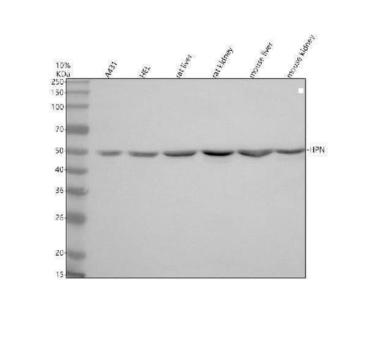 Anti-Hepsin/HPN Antibody Picoband® Boster Bio